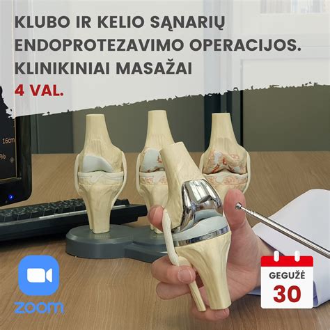 Sąnario endoprotezavimo schema