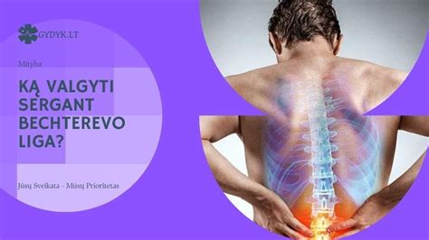 Stuburo deformacija sergant Bechterevo liga