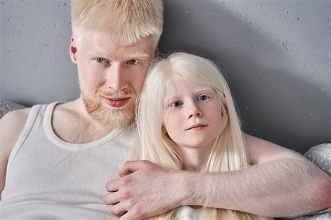 Albinosas vaikas Tanzanijoje