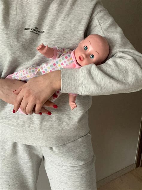 Kūdikio rankos padėtis po išnirimo