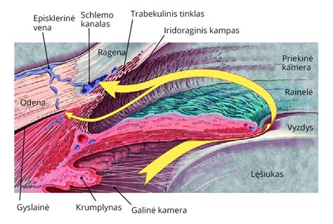 Palyginimas: akis su subkonjunktyviniu kraujavimu ir sveika akis