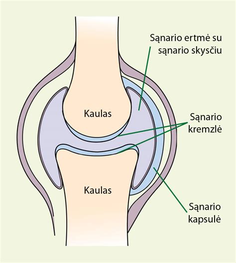 anatomine klubo sąnario sandara ir displazijos schema