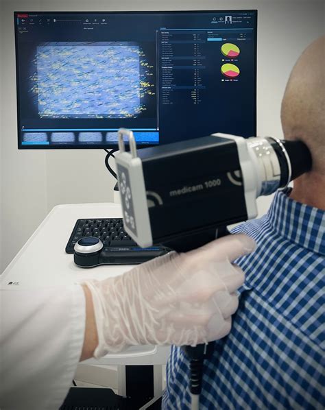 Odos darinių apžiūra dermatoskopu