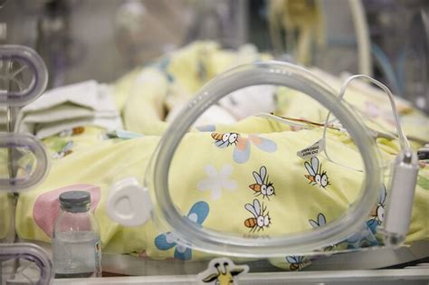 Saybie, mažiausia išgyvenusi mergaitė pasaulyje, ligoninėje