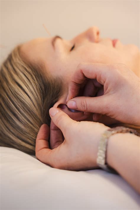 akupunktūros procedūra nėščiajai