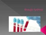 Laboratorinis kraujo tyrimo atlikimas