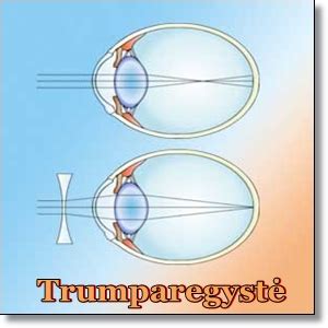 Trumparegystė: vaizdo fokusavimas prieš tinklainę