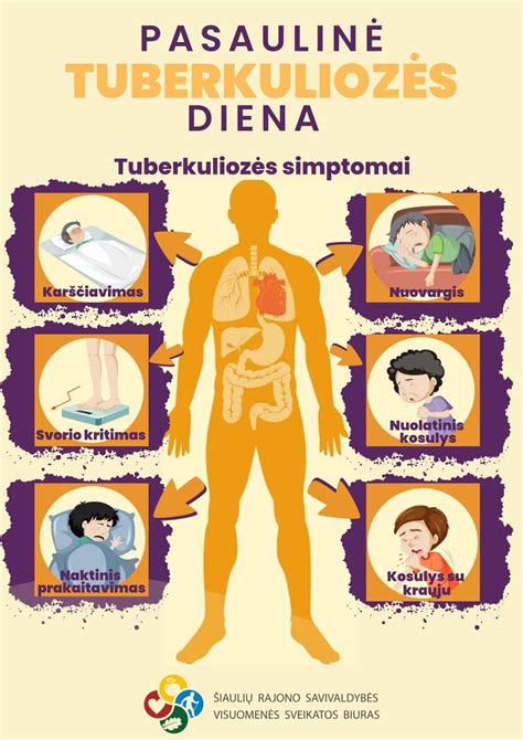 schema, vaizduojanti, kaip tuberkuliozės bakterijos plinta oro lašeliniu būdu