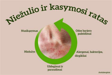 Niežėjimo-kasymosi ratas
