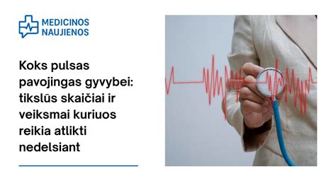 infografikas su 