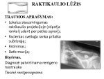 Naujagimio raktikaulio lūžis
