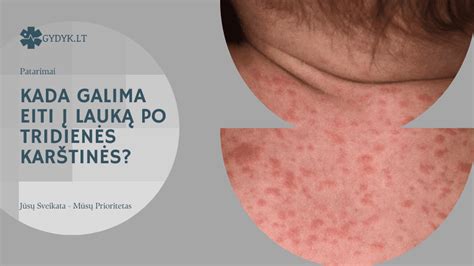 Kada galima grįžti į įprastą režimą po ligos?