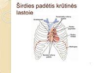 Širdies vieta krūtinės ląstoje, pavaizduota vaiko kūne
