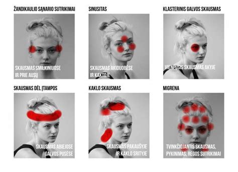 galvos skausmo anatomija ir sritys