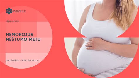 Hemorojus nėštumo metu: priežastys ir palengvinimas
