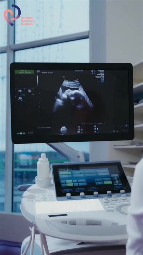 Vaisiaus vystymosi schematinis pavaizdavimas