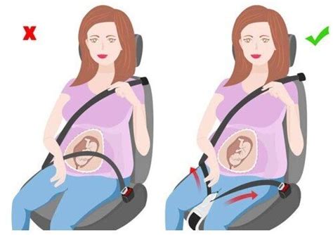 Nėščiosios saugos diržo segėjimo automobilį schema