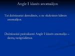 Sąkandžio anomalijų tipai