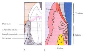 dantenų uždegimo ir periodontito iliustracija