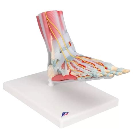 anatominė pėdos schema su galimų pažeidimų vietomis