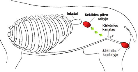 Nenusileidusi sėklidė diagrama
