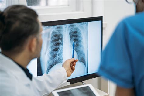 Rentgenogramos svarba diagnozuojant lūžius