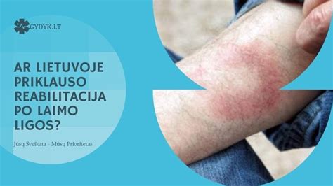 Sąrašas pavojingų simptomų po procedūros